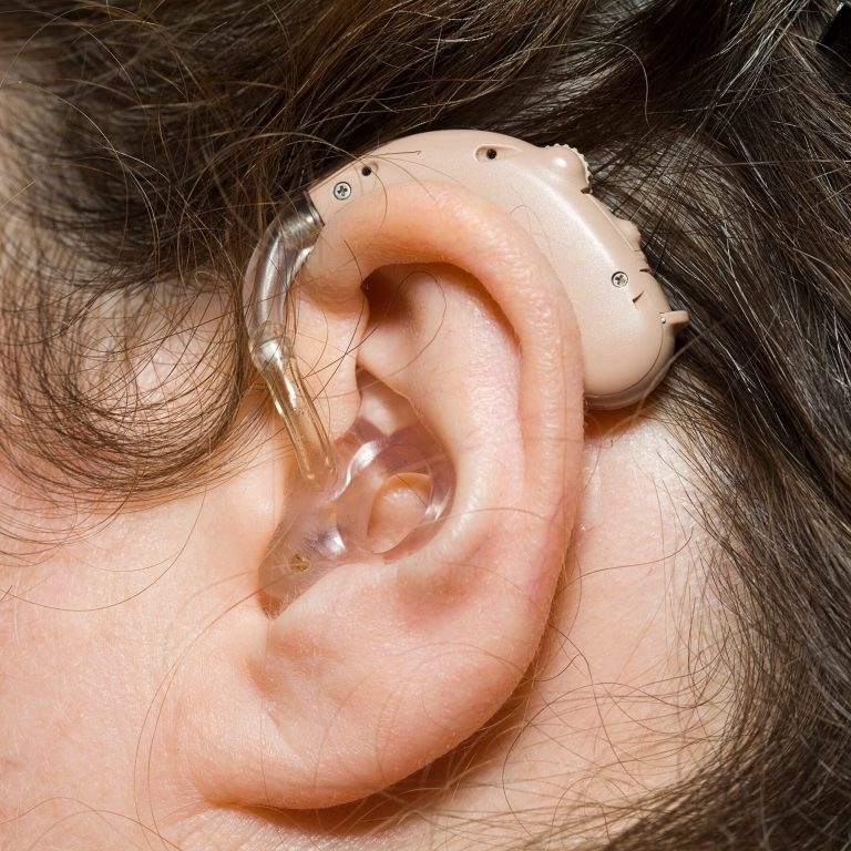 Efficacy of a Novel Hearing Aid Technology in Fort Worth